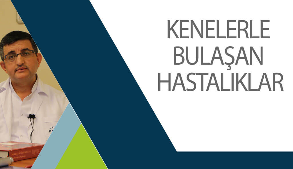 kenelerle-bulaşan-hastalıklar