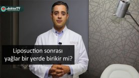 Liposuction sonrası yağlar bir yerde birikir mi