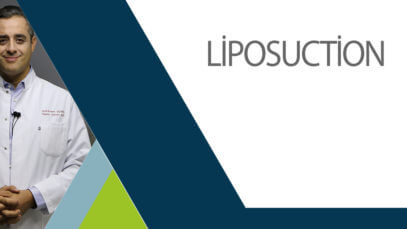 liposuction