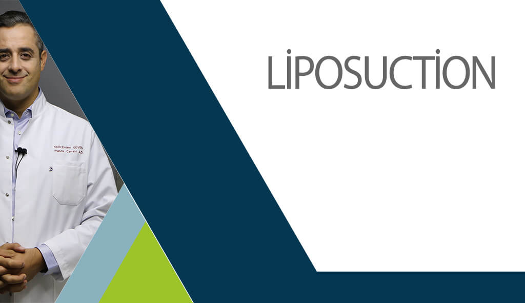 liposuction