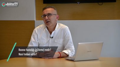 Rozase hastalığı (gülleme) nedir?