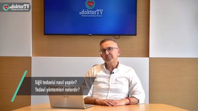 Siğil tedavisi nasıl yapılır? Tedavi yöntemleri nelerdir?