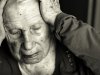 Alzheimer