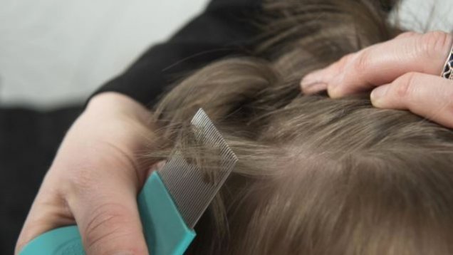 Kafa Bitlerine Ne Sebep Olur Nedenleri ve Riskli Faktörleri Nelerdir