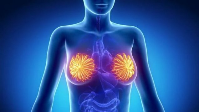 Meme Kanseri ve Genetik Test Nedir Genetik Test Sonuçlarını Nasıl Yorumlanır