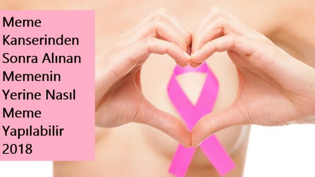 Meme Kanserinden Sonra Alınan Memenin Yerine Nasıl Meme Yapılabilir 2018