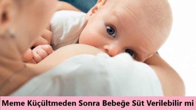 Meme Küçültmeden Sonra Bebeğe Süt Verilebilir mi