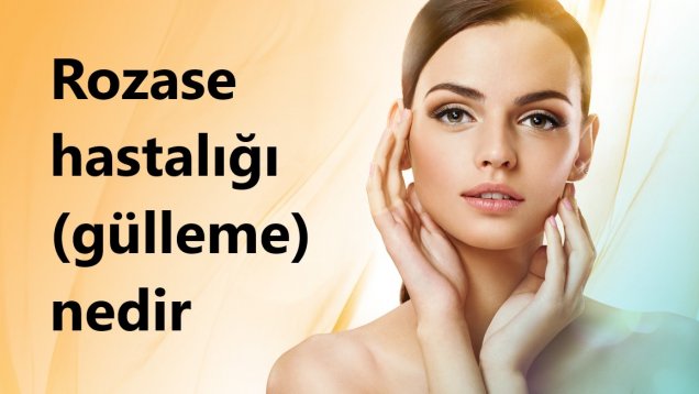 Rozase hastalığı (gülleme) nedir