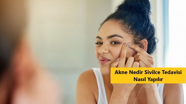 Akne Nedir Sivilce Tedavisi Nasıl Yapılır
