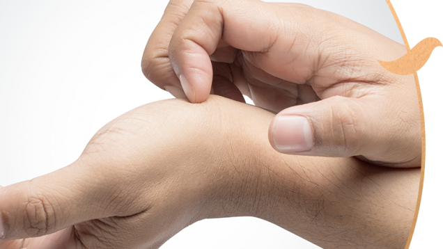 Liken Planus Nedir Belirtileri Nelerdir