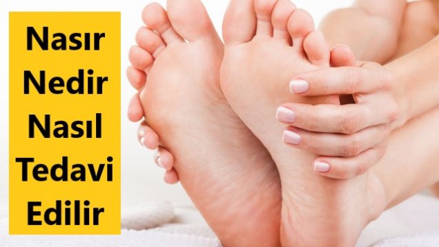 Nasır Nedir Nasıl Tedavi Edilir