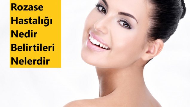 Rozase Hastalığı Nedir Belirtileri Nelerdir